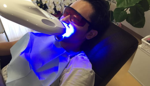 歯のセルフホワイトニング初体験｜所沢のスマイルケア(SMILE CARE)で施術。30分で目に見えて変わって驚き！